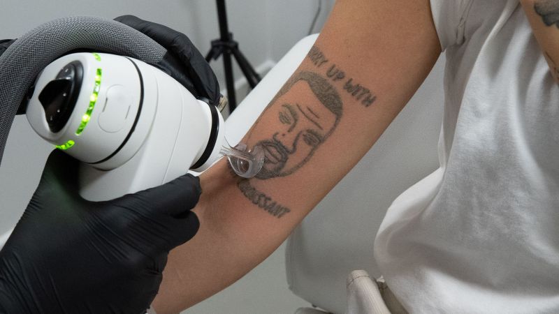 Studio penghapusan tato London ini masih akan menghapus tato Kanye West secara gratis